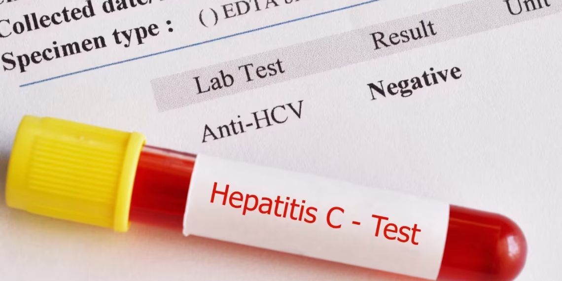 Mostar: Besplatno testiranje studenata na HIV i hepatitis na Kampusu SUM-a